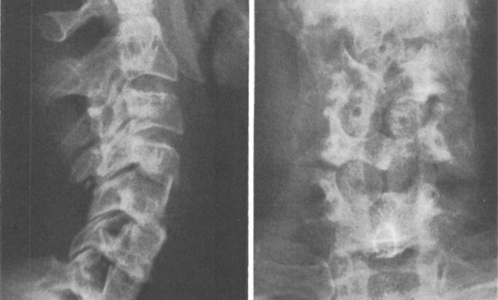 full-jns_1970_33_6_0682.fig002